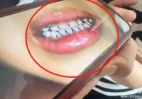 甘肃天水幼儿园铅中毒应该不是故意投毒而是不知添加剂内含铅